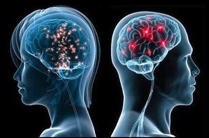 Mental Diseases